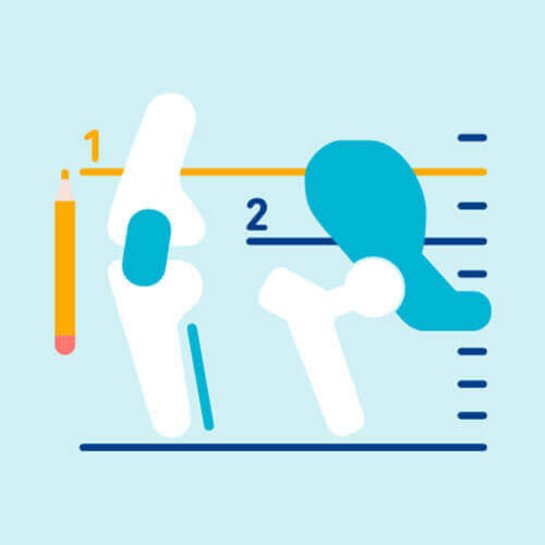 Illustration zur Größe des Kniegelenks im Vergleich zum Hüftgelenk.